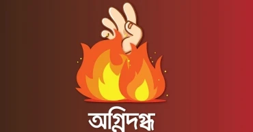 রাজধানীতে দোকানে অগ্নিকাণ্ডে দগ্ধ ৩