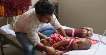 হাম ও ‎হামের উপসর্গ নিয়ে আরও ৫ প্রাণহানি, আক্রান্ত ১০২৫