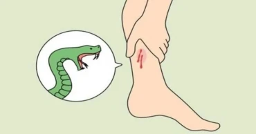 বন্যার পর ফেনীতে সাপ আতঙ্ক, গৃহবধূর মৃত্যু