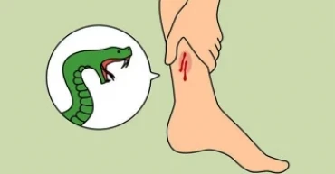 ঘুমন্ত অবস্থায় সাপের কামড়ে শিশুর মৃত্যু