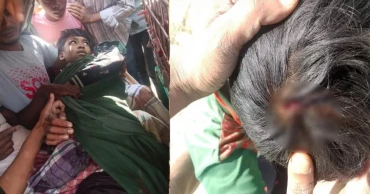 মিয়ানমার থেকে ফের গুলি, টেকনাফ সীমান্তে দুই কিশোর গুলিবিদ্ধ