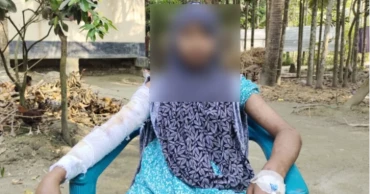 Teen domestic worker scalded with hot water in Barishal