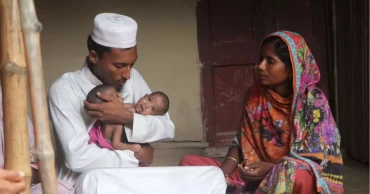 Conjoined twins from Kushtia die at DMCH