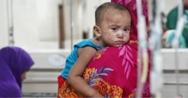 Measles death toll stands at 950 as 7 more children die in 24 hrs