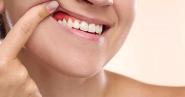 Short-term fasting may help reduce gum disease inflammation, study finds