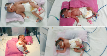 Noakhali woman gives birth to quadruplets