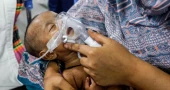 হাম: আরও ৮ শিশুর মৃত্যু, আক্রান্ত ১৬১৫