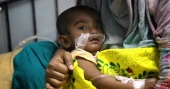 সিলেটে হামের উপসর্গে আরও ৪ শিশুর মৃত্যু, প্রাণহানি বেড়ে ১৬৪
