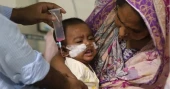 হামের উপসর্গ নিয়ে আরও ৫ প্রাণহানি, মৃত্যু বেড়ে ৮১০