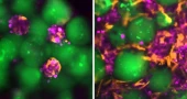 MIT researchers develop injectable ‘mini livers’ to support damaged organs