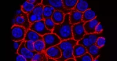 New drug offers hope for advanced pancreatic cancer treatment