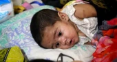 Measles death toll stands at 938 as 5 more children die in 24 hrs