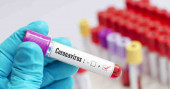 Coronavirus: Five more test positive in Rajshahi