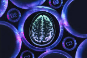 Biogen reanalyzes studies, presses ahead on Alzheimer's drug