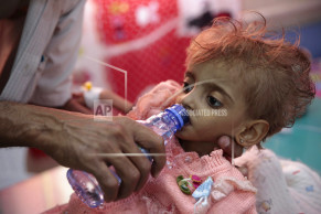 Key battle in Yemen's war risks tipping country into famine