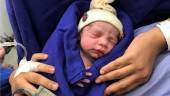 1st baby born using uterus transplanted from deceased donor