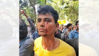 Protesting DU students attacked on campus