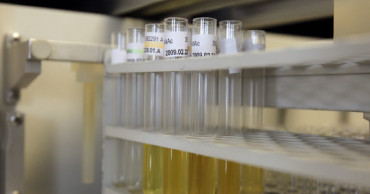 Simple urine test can help improve early detection of bladder cancer: WHO study