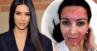 Kim Kardashian West sues doctor over 'Vampire Facial'
